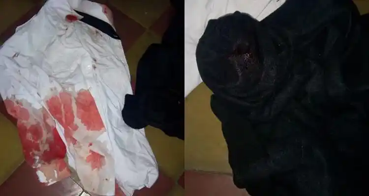 Delincuentes quisieron robar en el expredio de Coplac y acuchillaron al sereno
