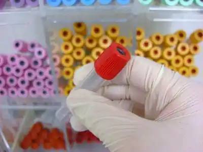 Colombia sobrepasa los 154 mil contagiados con COVID-19