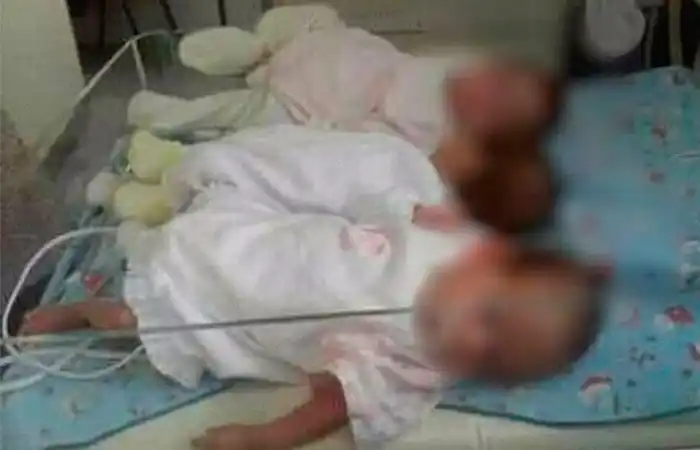 Un médico guardó en formol 257 cuerpos de bebés