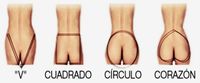 Aumento de Glúteos Hibrido