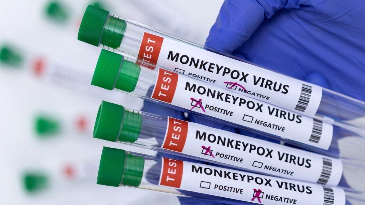 Hospitales de Madrid comienzan a realizar PCR para diagnosticar la viruela del mono