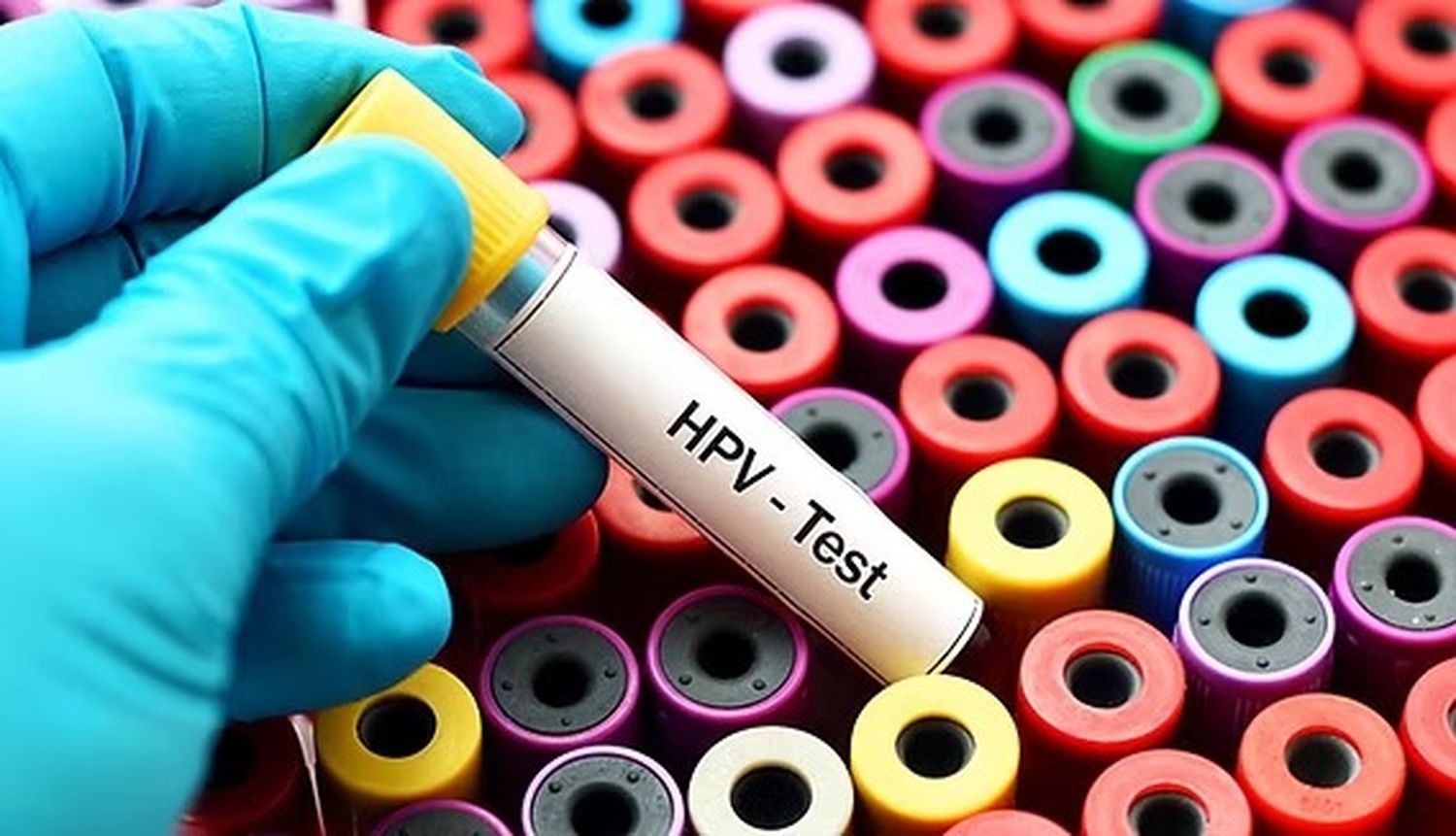 Cuatro de cada cinco personas contraerán HPV en algún momento de su vida