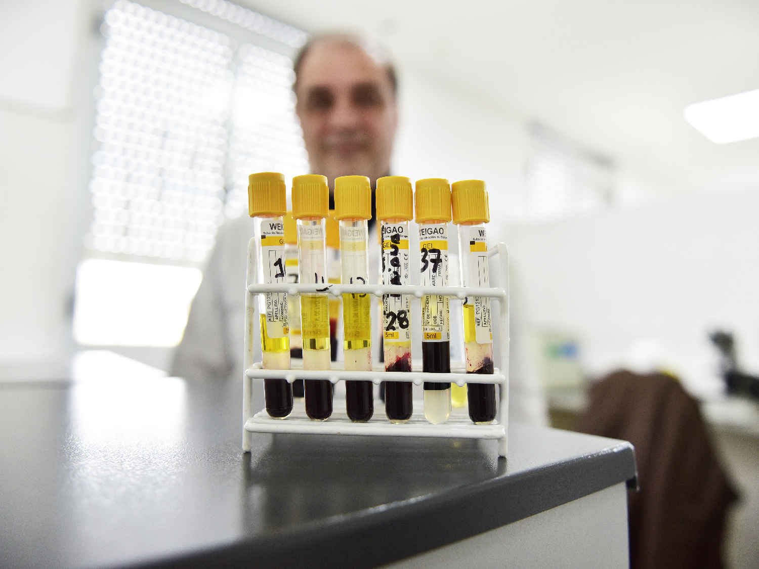 VIH: bajó un 40 % los testeos durante la cuarentena en el Hospital
