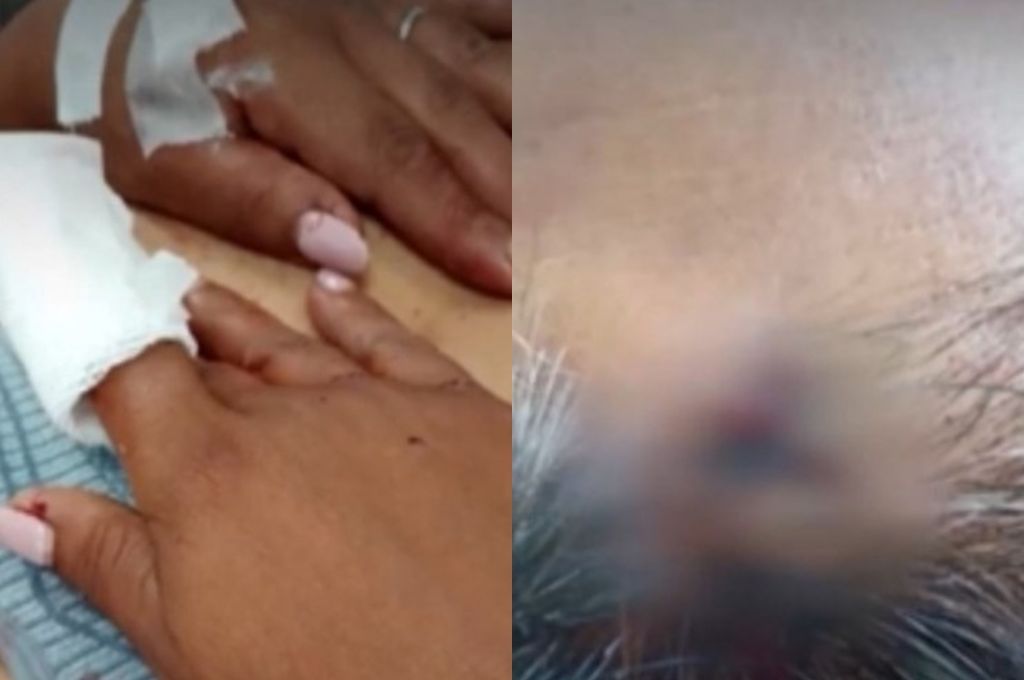 Las heridas causadas por el malviviente.