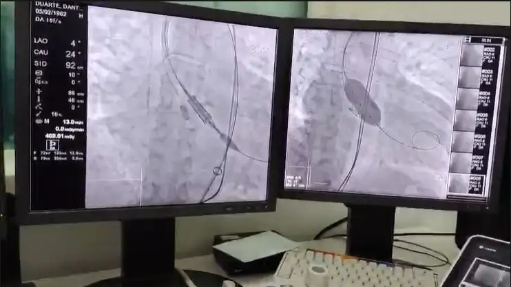 CIRUGÍA CARDIACA HIGA 2