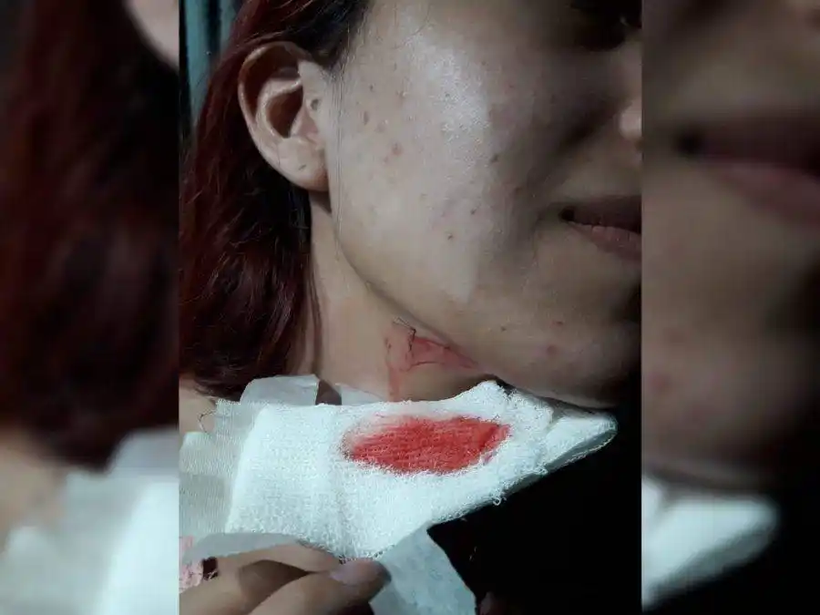 Violento robo a una joven: le cortaron el cuello por un celular
