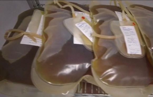 AVANCES CIENTÍFICOS Desarrollan un suero contra la covid-19 a través del plasma de caballos