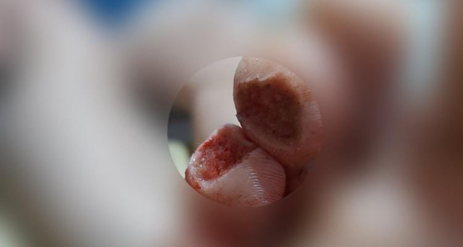 Palometas en Pescadores: Buscan alternativas para ahuyentar un cardumen que mordió a socios en la playa