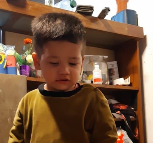 Tiene 3 años y el 70% del cuerpo quemado con grasa caliente: el relato de su madre