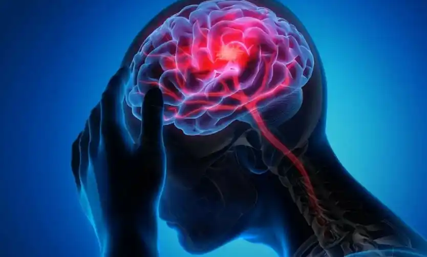 Reconocer los síntomas de un ACV y actuar a tiempo puede salvar vidas
