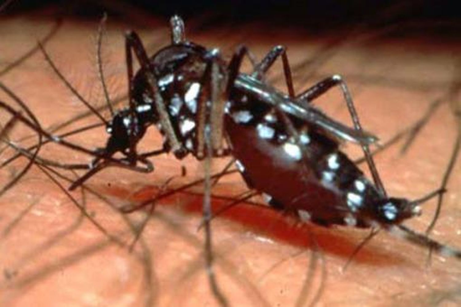 Confirman el primer caso de dengue autóctono en Buenos Aires
