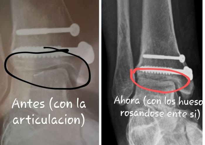 Antonela Suárez