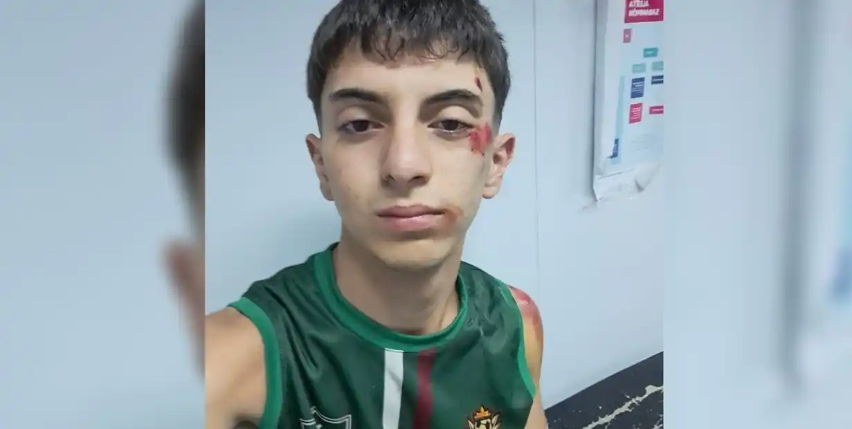 Salió al sonar la sirena para ir al cuartel y lo asaltaron: brutal ataque a bombero voluntario de 18 años en Longchamps