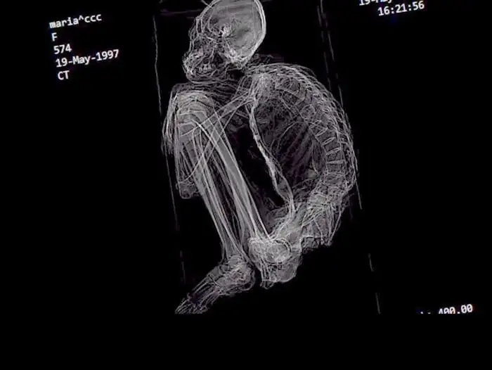 ¡Mirá el video! Encuentran en Perú la momia de un ser "no humano"