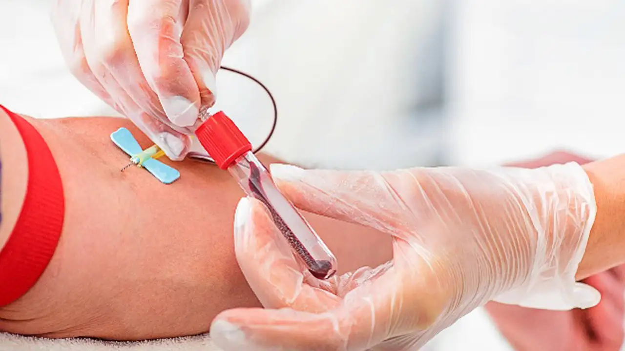 En 2018 diagnosticaron 19 pacientes con VIH  