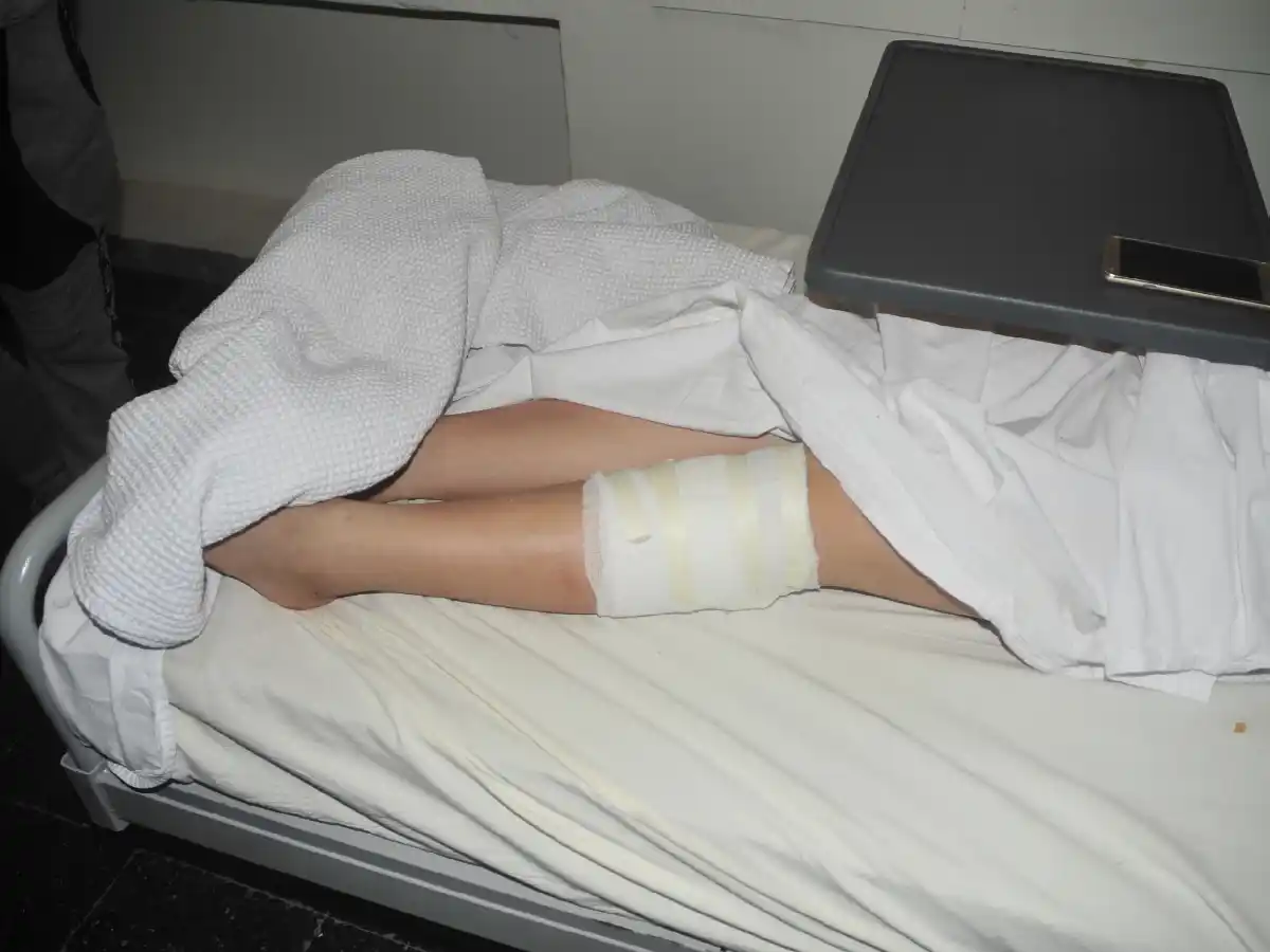 Sigue internada la joven atacada por dos perros en Frontera 