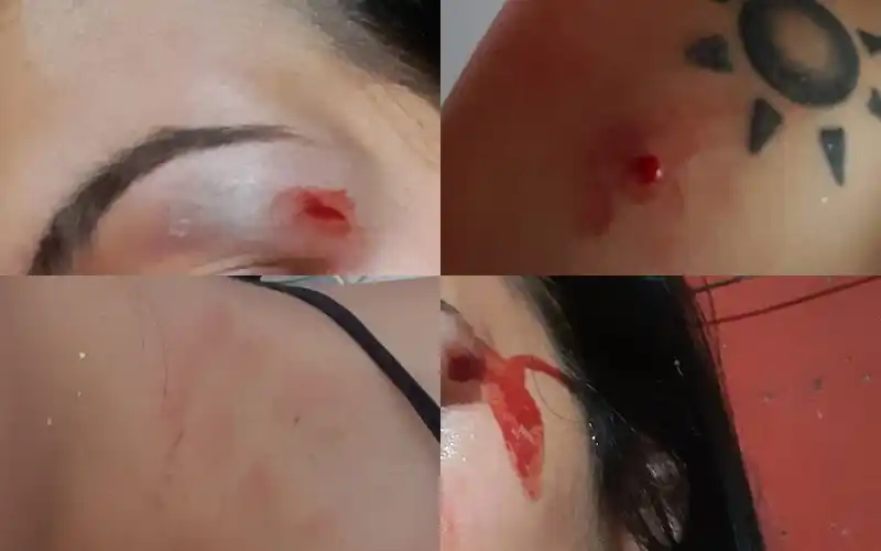 Joven denunció a su expareja por abuso sexual, golpes y amenazas y le impusieron una restricción perimetral