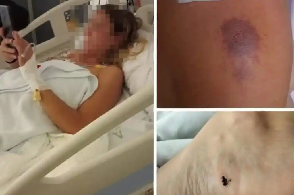 Málaga: fue a colgar la ropa y un rayo la atravesó desde el hombro hasta el pie