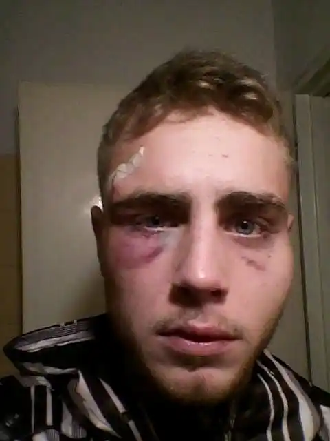 Denunció una feroz golpiza de patovicas en un boliche