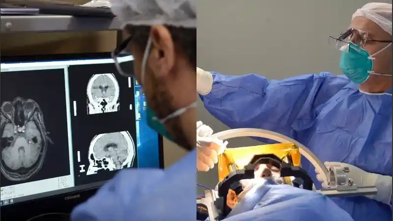 Realizaron una “neurocirugía funcional” a un paciente psiquiátrico grave