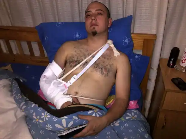 Le quebraron el brazo a patadas para robarle el reloj y el celular