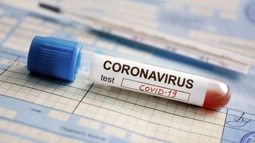 Se registraron 65 nuevos casos de covid-19 en Entre Ríos
