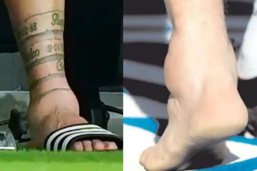 Las duras imágenes del pie de Messi