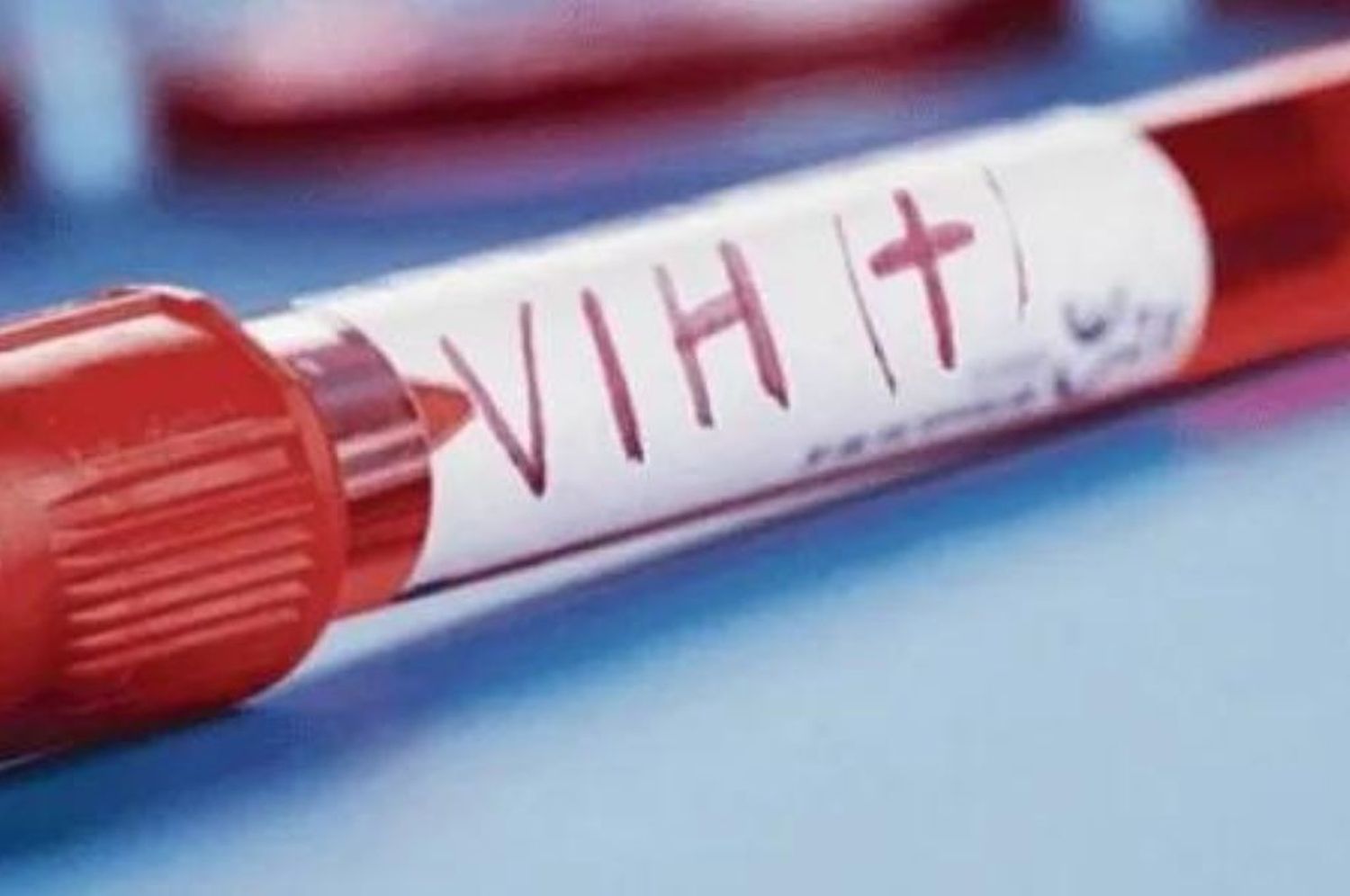 Se confirmó el tercer caso de curación de VIH en el mundo