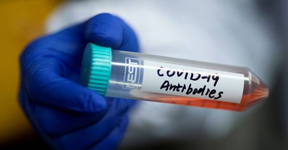 Los anticuerpos contra el covid-19 persisten más de tres meses después de la infección