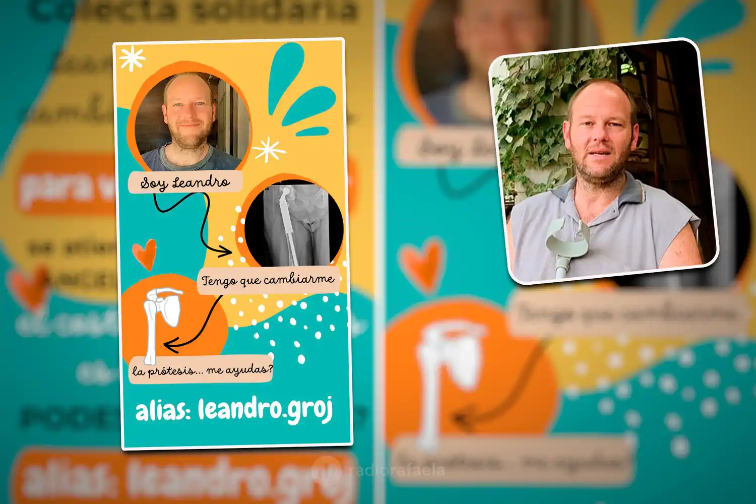 “La única solución es cambiar la prótesis”: un emprendedor rafaelino necesita ayuda para afrontar una cirugía costosa