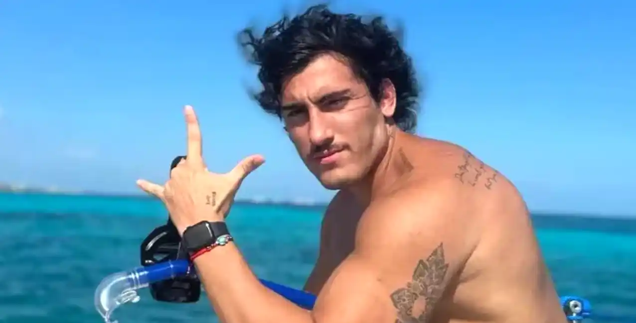 Tomas Holder se operó la cara y compartió el resultado en sus redes: “Un cambio lindo y fino”