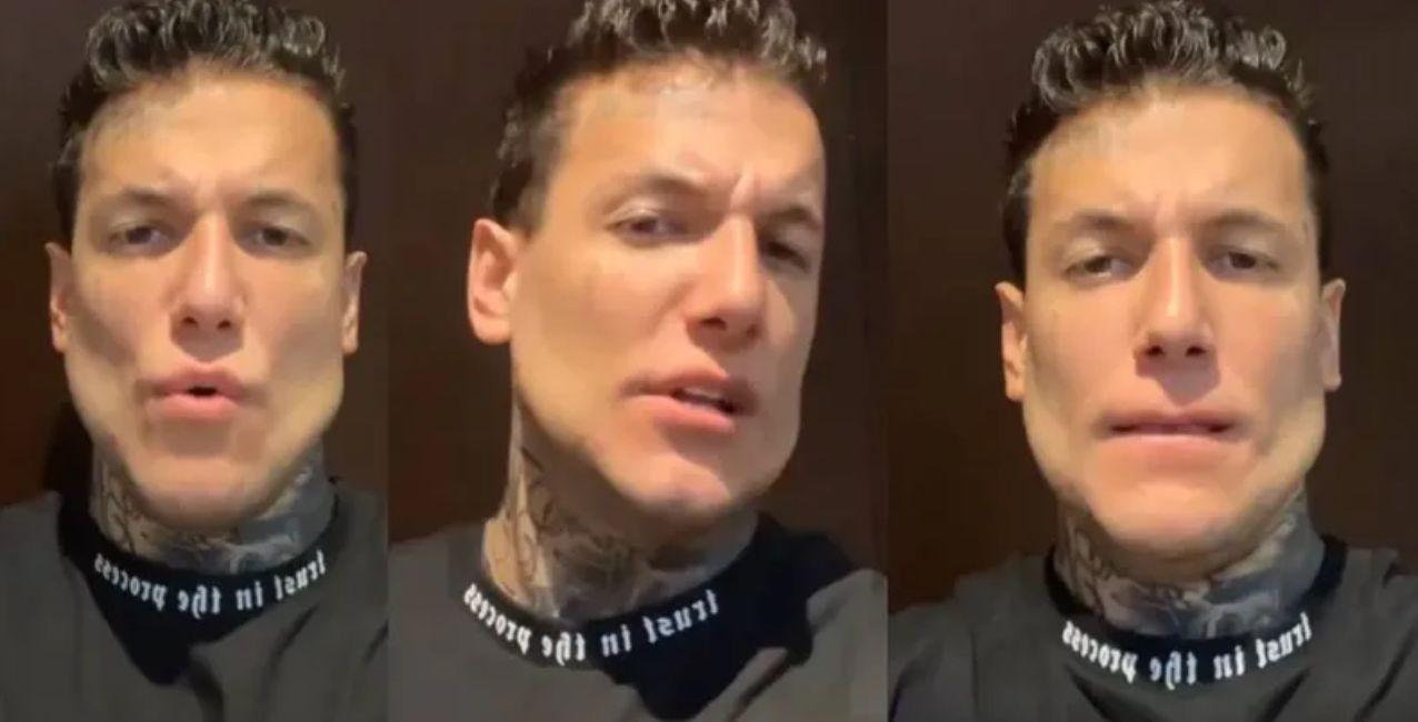 Alex Caniggia se realizó una operación de mandíbula: las fotos