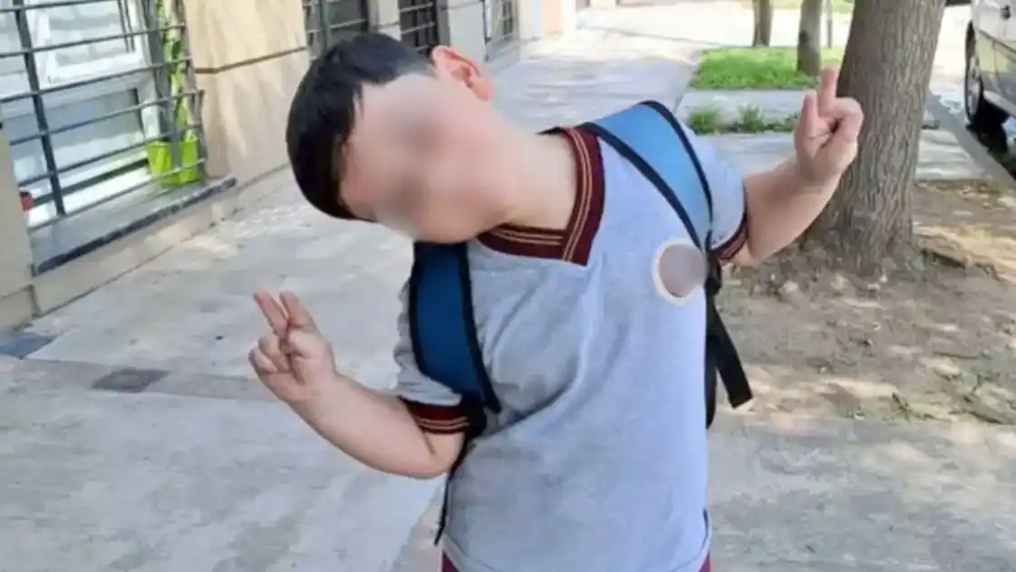 Operan por tercera vez al niño que chocó a bordo de un UTV en Pinamar