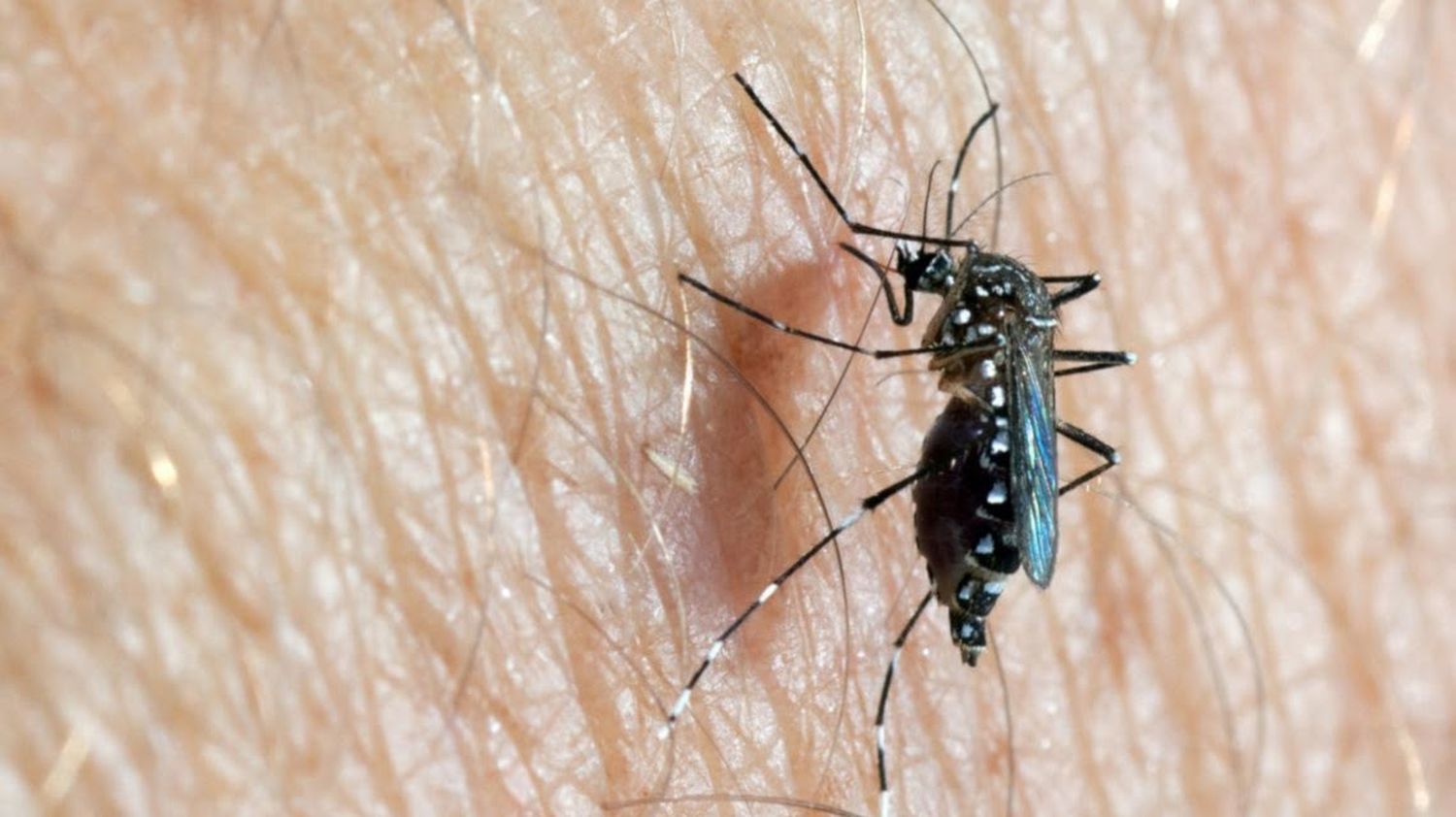 Recomendaciones para prevenir el Dengue