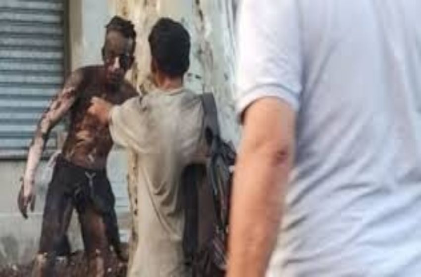Video: un joven que trató de robar cables en zona oeste dejó sin luz a los vecinos y terminó grave en el Heca
