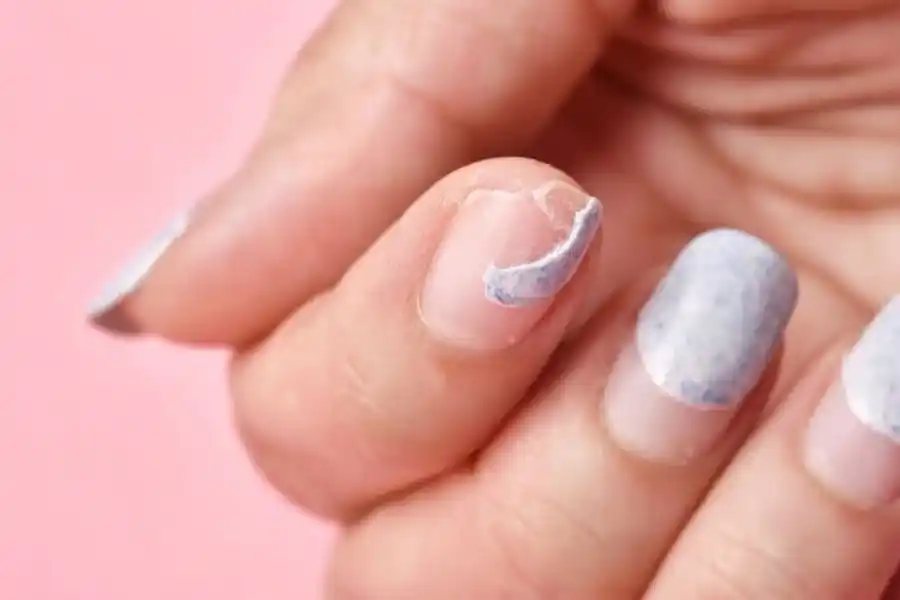 Abuso de esmaltado o endurecedores con productos químicos también pueden ser una causa