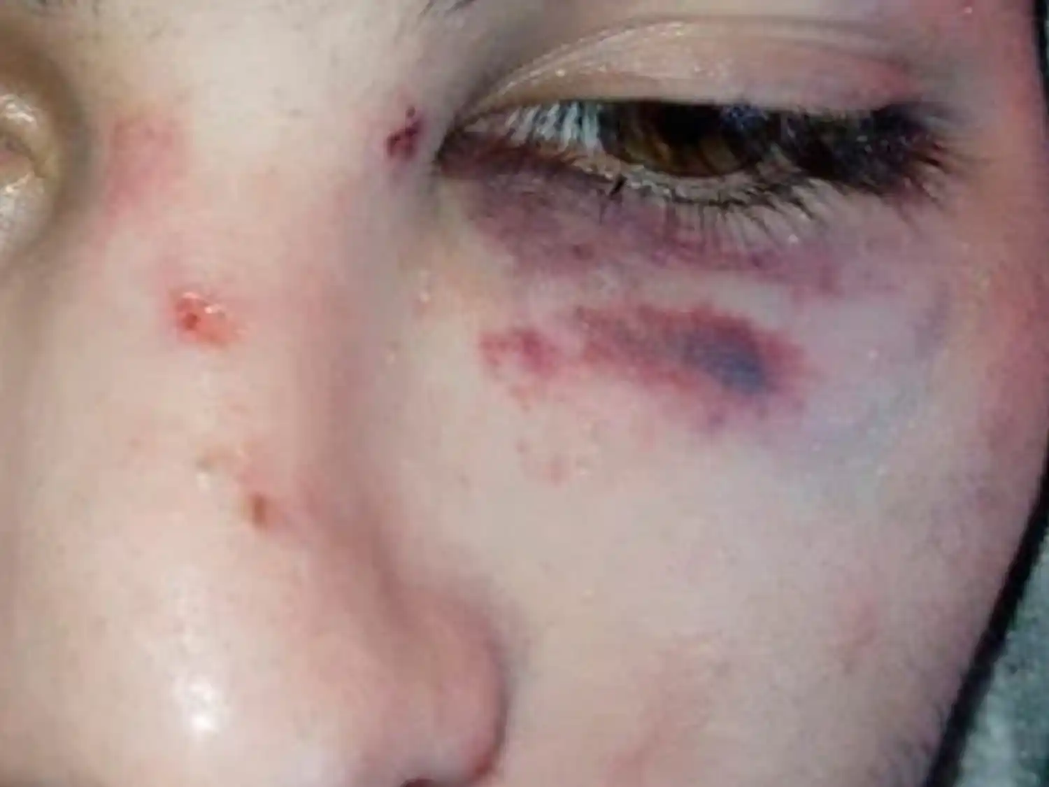 Atacaron a golpes a un joven de Gualeguaychú y terminó hospitalizado en el Centenario