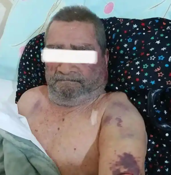 Delincuentes maniataron y molieron a golpes a un adulto mayor: así lo dejaron