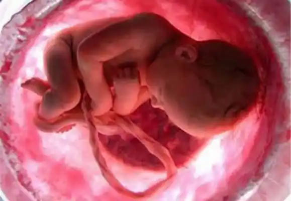 Avanza un proyecto de ley para prohibir el aborto en Entre Ríos 