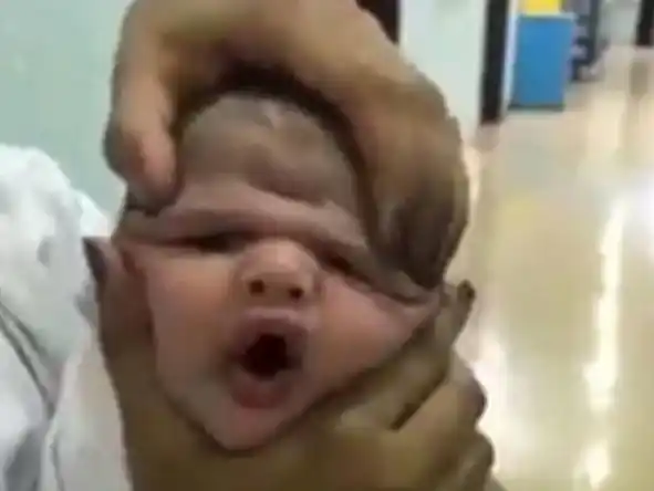 Video: despidieron a tres enfermeras por maltratar a un bebé recién nacido