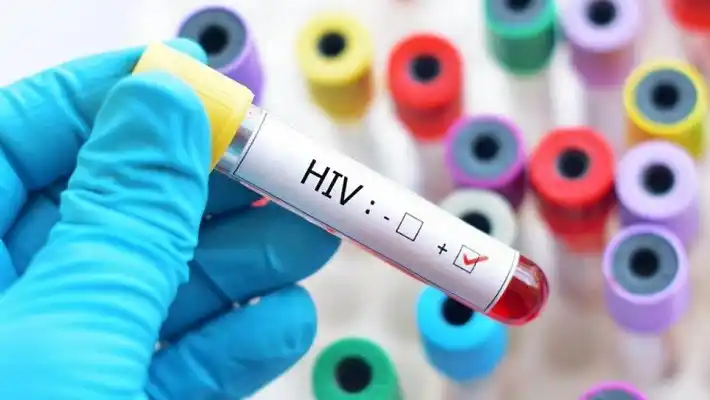 Un estudio francés descubrió una fórmula que permite eliminar el virus del VIH