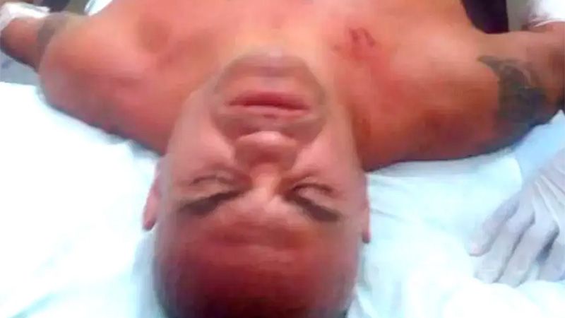 Dieron de alta a "La Hiena" Barrios tras ser apuñalado en confuso episodio