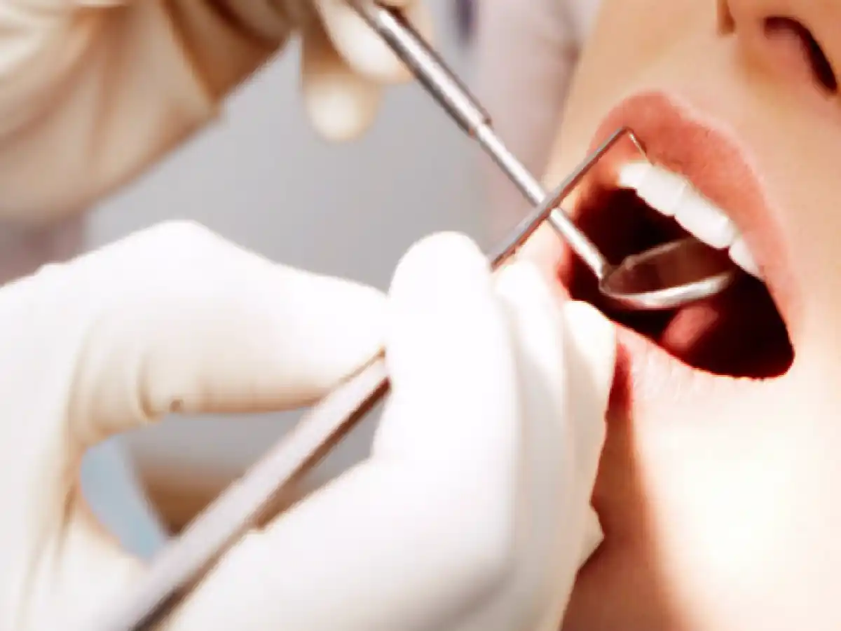 Cáncer bucal: advierten falta de conciencia sobre controles y el diagnóstico precoz