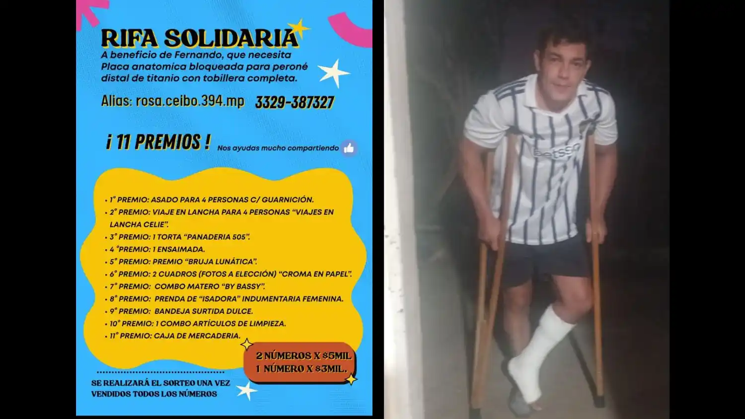 Fernando Krispien sufrió un accidente y se fracturó el peroné. Necesita una prótesis.