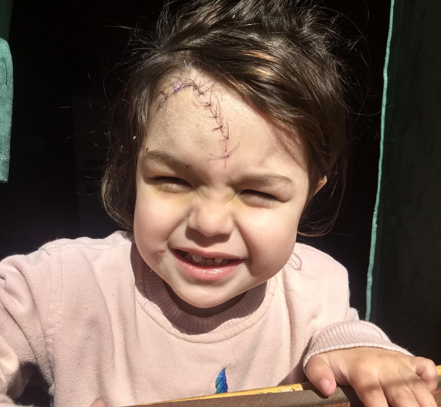 La mamá de Luz, la nena que fue atacada por un perro, agradece la colaboración de los vecinos para afrontar su tratamiento