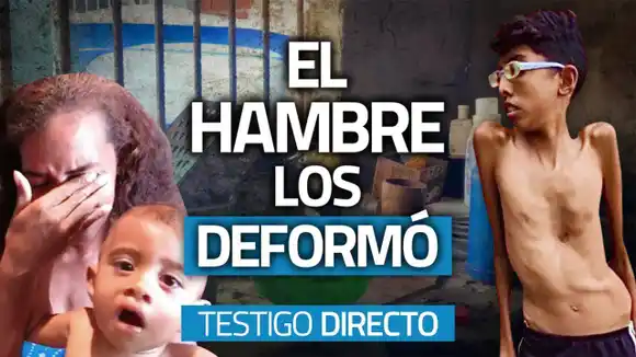 TESTIGO DIRECTO- El hambre los deformó