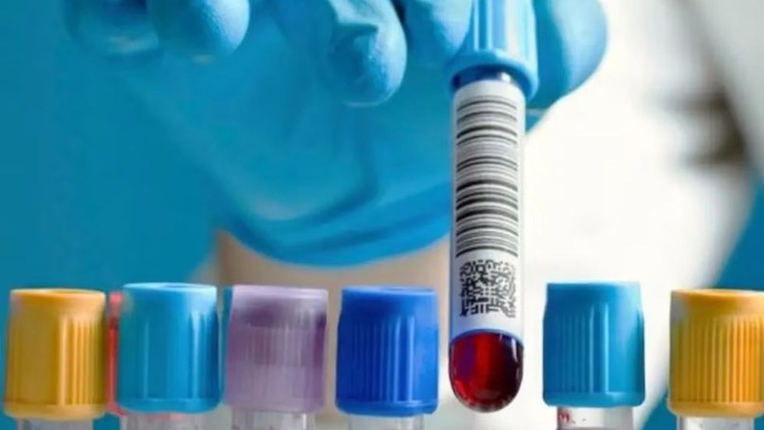 Los bioquímicos cobrarán un copago a los pacientes de prepagas: de cuánto será el monto