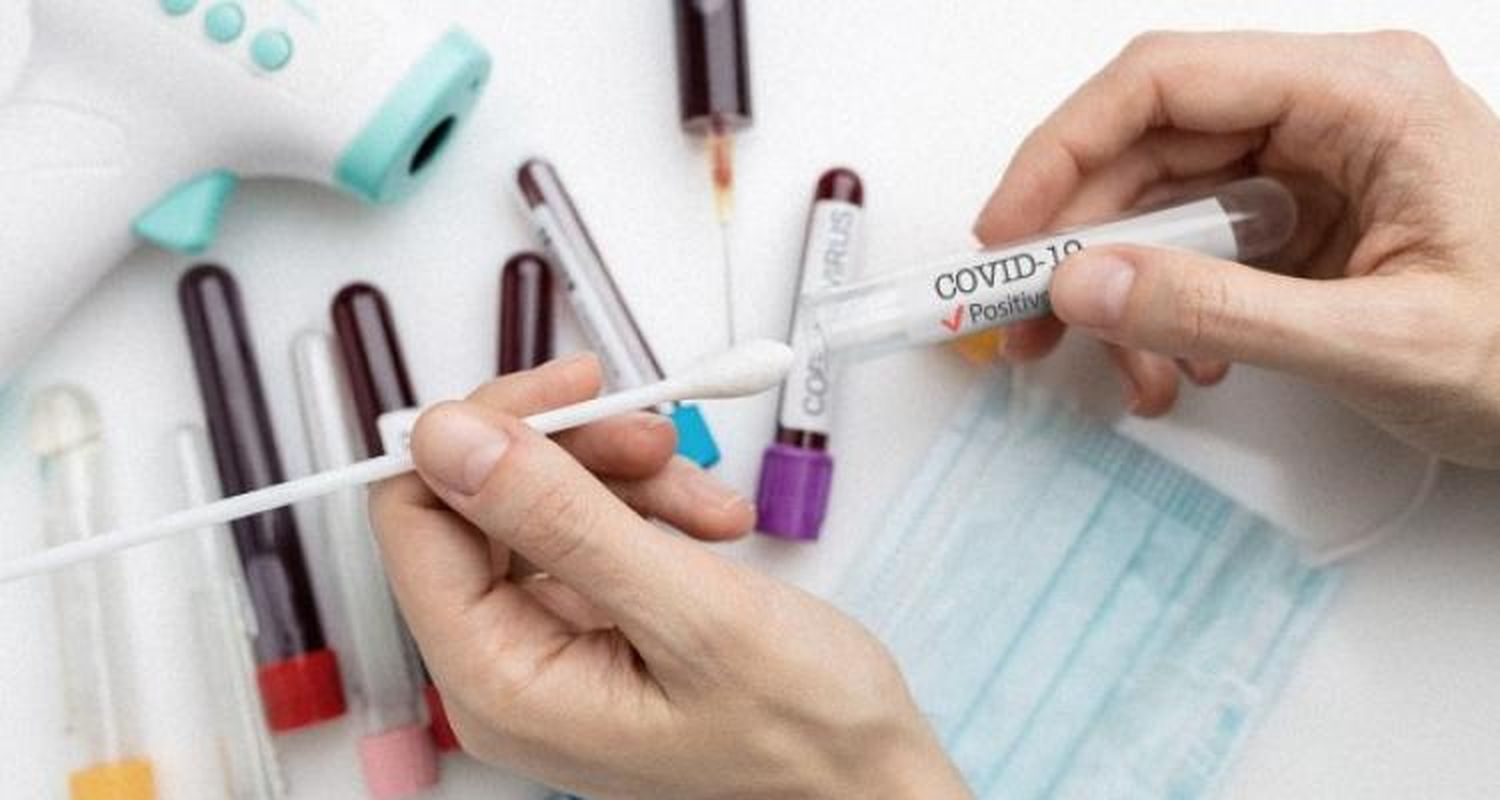 Coronavirus: 48 nuevos casos positivos por hisopado y récord de 288 pacientes activos
