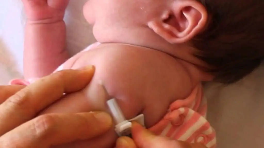Refuerzan la vacunación neonatal: incorporan la BCG en clínicas privadas
