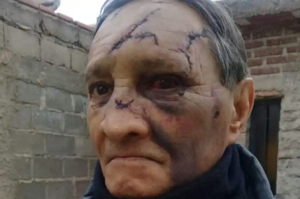 San Luis: lo golpearon salvajemente con un martillo para robarle